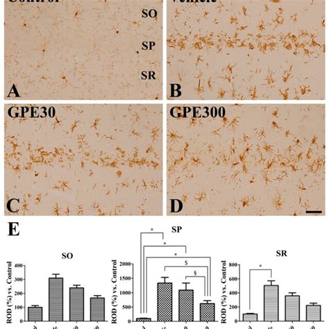 Immunohistochemistry for Iba-1 in the CA1 region of the control (A ... 