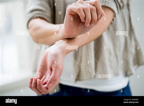 Woman Applying Estrogen Gel On Hi Res Stock Photography And Images Alamy