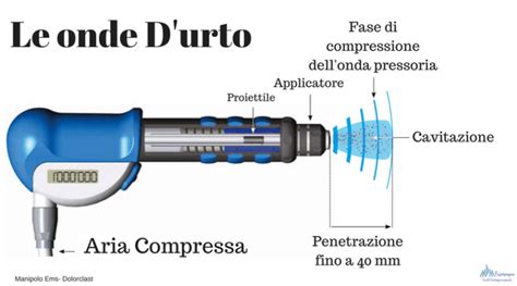 Differenza Tra Onde D Urto Focali E Onde D Urto Radiali Facciamo