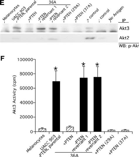 Increased Akt3 Expression And Activity Occur During Melanoma Tumor