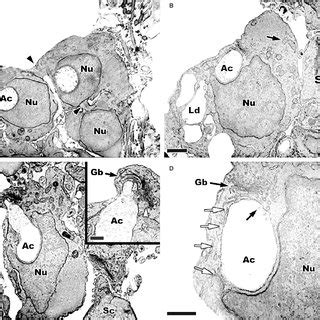 Late developing round spermatids and early elongating spermatids within ... 