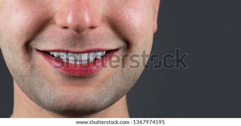 20 Unit Bq Veneers Stock Photo 1367974595 Shutterstock