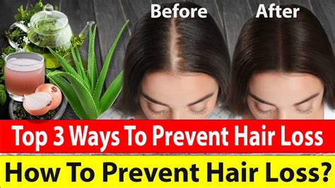 How To Prevent Hair Loss Youtube