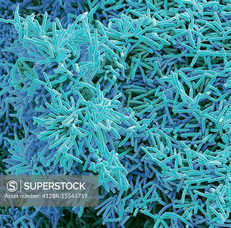 Plaque-forming bacteria, SEM - SuperStock