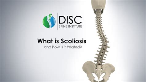 A Brief Overview Of Scoliosis Disc Spine Institute Tx