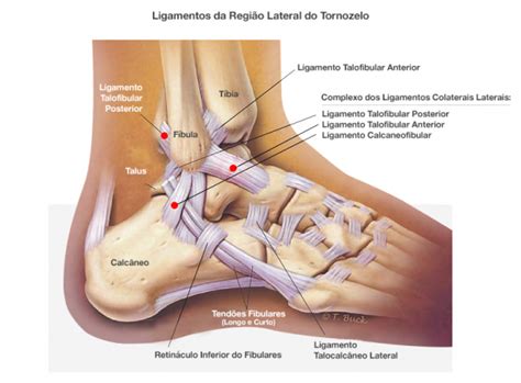 Saiba Tudo Sobre Les Es No Tornozelo Wp Pilates E Sa De