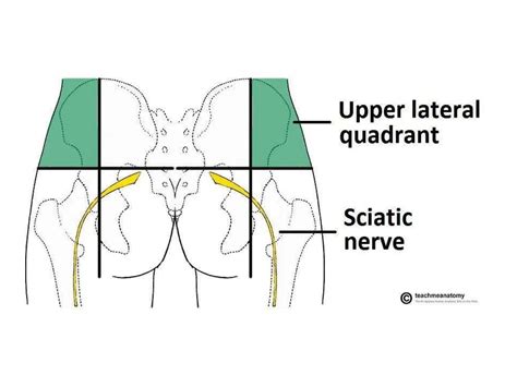 Sciatic Nerve Anatomy | PPT