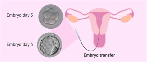 Embryo Transfer To The Maternal Uterus