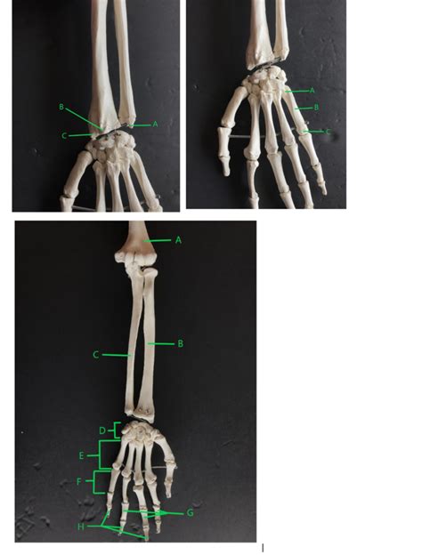 Bony Landmarks Of Forearm Hand Diagram Quizlet