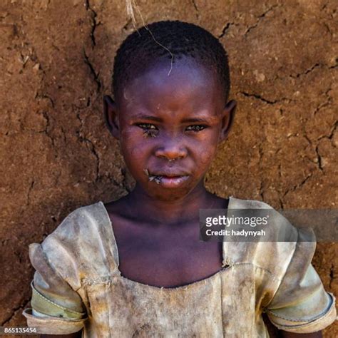 2,474 Hungry Child Africa Stock Photos, High-Res Pictures, and Images ...