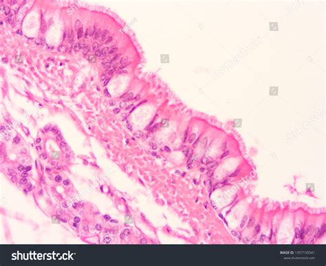 Trachea Cartilage Rings Human Tissue Stock Photo 1357150541 | Shutterstock