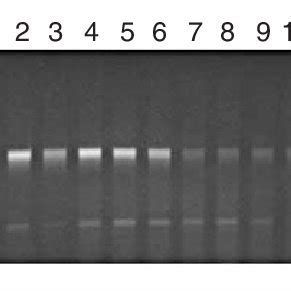 Representative 1 5 Agarose Gel Of RT PCR Amplifications Targeting 500