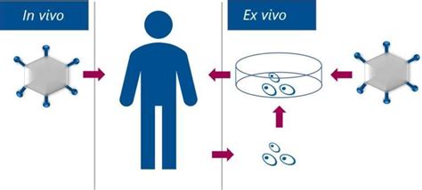 Viral Vector And Gene Therapy Basics Summarized Biovian