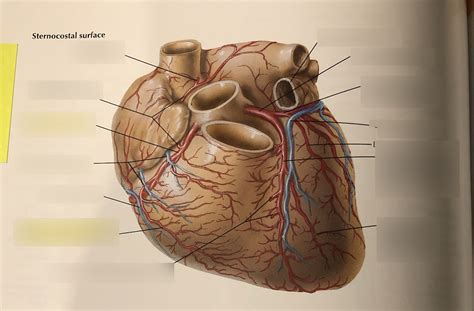 Cv Anatomy Practical Netters Heart 1 Sternocostal Surface Diagram