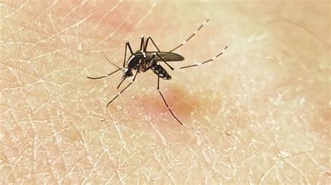 Qué Es Mosquito Tigre Y Cuáles Son Los Síntomas De Su Picadura España Times