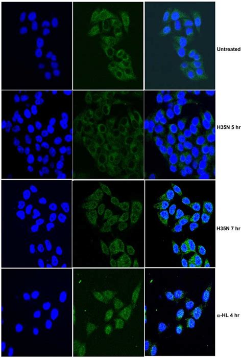 H35N Induces Translocation Of SREBP 1 To The Nucleus HeLa Cells Were