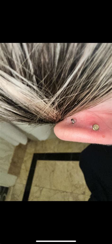 Infected Piercing Rpiercing