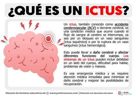 Qué es un Ictus Definición de Ictus