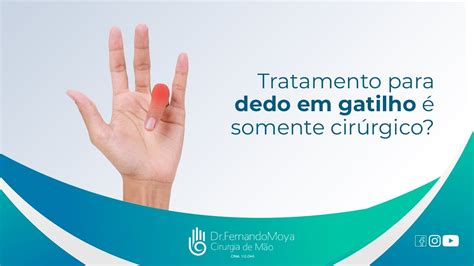 Tratamento para Dedo em gatilho é somente cirúrgico Dr Fernando