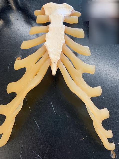 Real Thoracic Cage Anterior View Diagram Quizlet