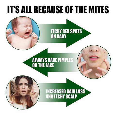 3x Bed Bug And Dust Mite Killer Natural Spray Treatment ,Green