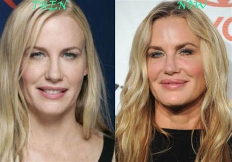 Daryl Hannah Before And After Plastic Surgery Celebrity Plastic