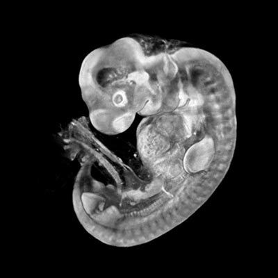 D Human Embryo Models