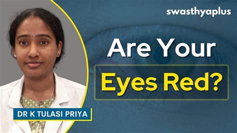 Redness In Eyes Symptoms Treatment Dr K Tulasi Priya Youtube