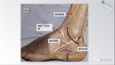 踝关节解剖高清图解值得收藏 好医术早读文章 好医术 赋能医生守护生命