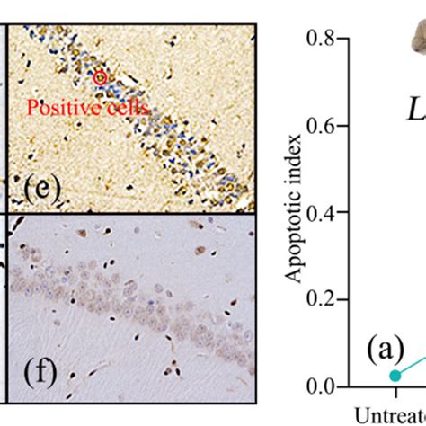 Microscopic observation of the apoptosis in the hippocampal CA1 region ... 