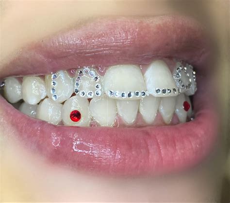 Tooth Gems Tooth Gem Diamond Teeth Dental Jewelry