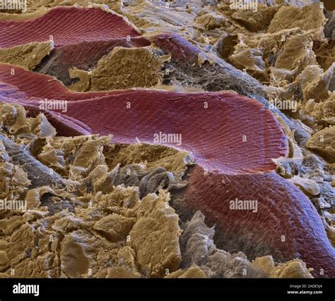 Striated Muscle Tissue Coloured Scanning Electron Micrograph Sem Of