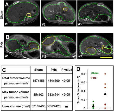 Accelerated Carcinogenesis Following Liver Regeneration Is Associated