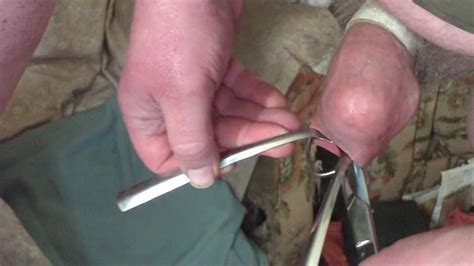 Foreskin With A Table Tennis Ball Scissors Two Spoons Gay Amateur Amateur Porn Xhamster