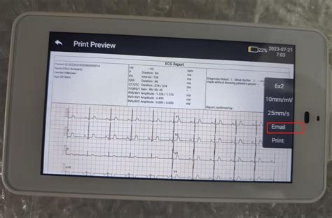 Mobile 6/12-Lead EKG/ECG Machine Fits into Your Pocket, with Auto ...