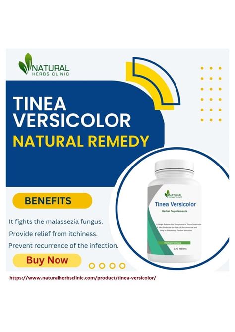 Natural Remedies for Tinea Versicolor | PDF