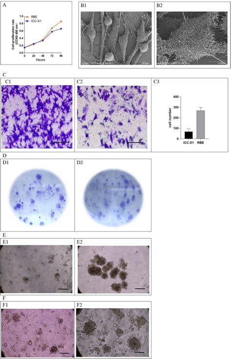 Population Doubling Time Ultrastructure Cell Migration Ability Plate