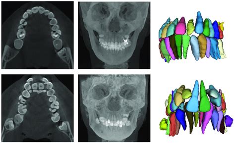 Display Of The Complicated Dental Structures From Left To Right The