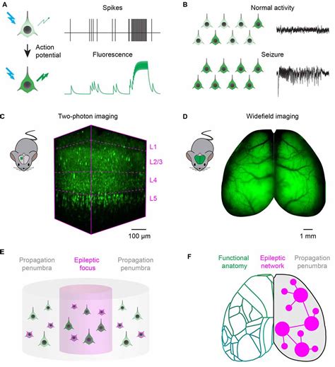 Frontiers The Enlightened Brain Novel Imaging Methods Focus On