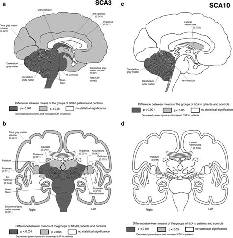 Volumetric comparison of SCA3 patients and their controls (left) and ...