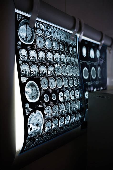 Brain Regions That Bias The Brains Response To Pleasure In Bipolar