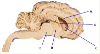 week 10 neuroanatomy 2 midbrain functions Diagram | Quizlet