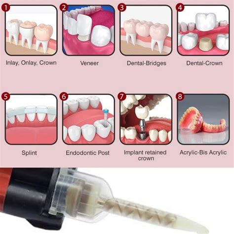 Extra Strong Permanent Dental Cement For Caps Crowns Bridges Posts