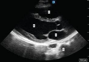 Cardiac Ultrasound | Radiology Key