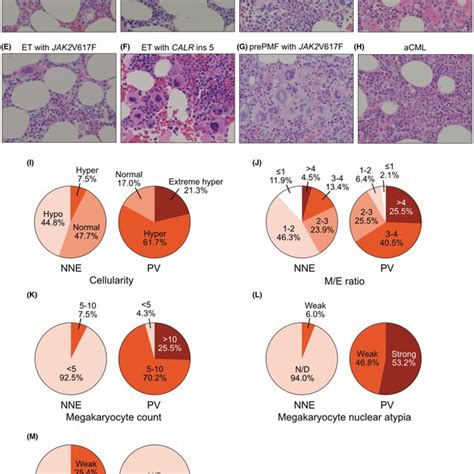 Pathological Features Of Bone Marrow Biopsies Of Nonneoplastic