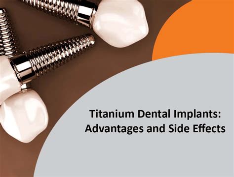 Titanium Dental Implants: Advantages and Side Effects — Acacia Dental