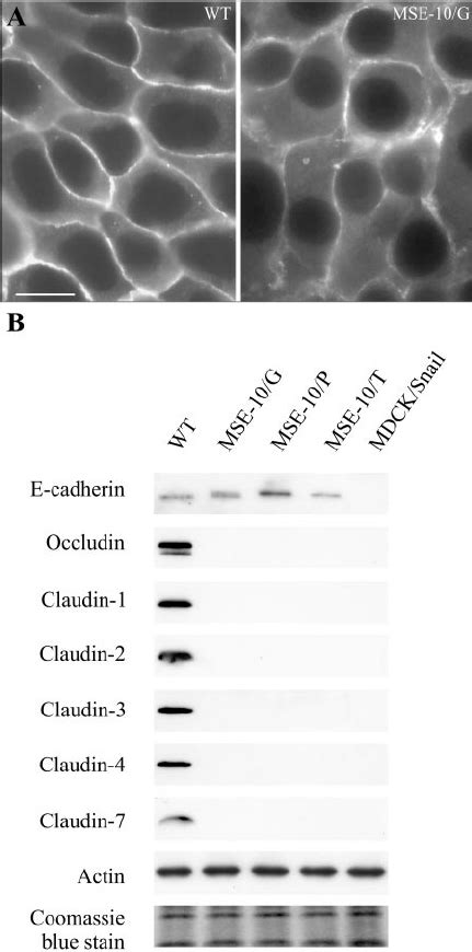 Expression Of E Cadherin In Mdck Ii Cells Constitutively Overexpressing Download Scientific