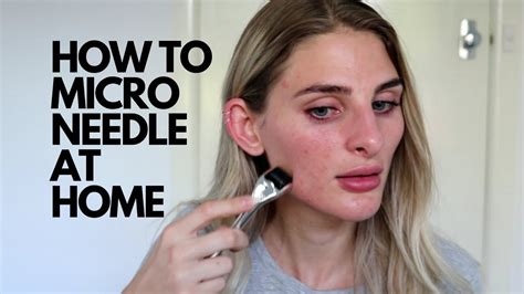 Microneedling At Home Tutorial Youtube