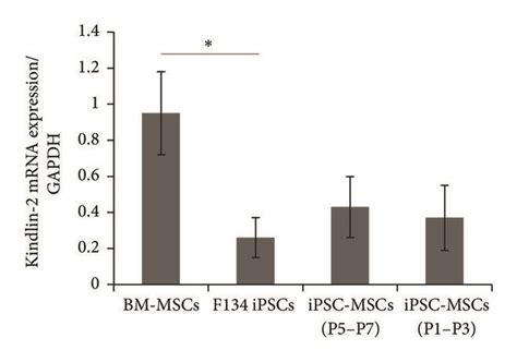 Kindlin 2 Expression Pattern Overexpressionknockdown And Targets