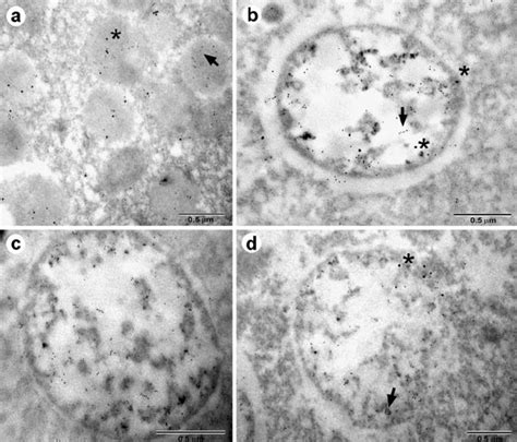 Double Immunogold Labelling Of β Gus 10 Nm Arrows And Hex 20 Nm